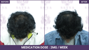 before-after-medication